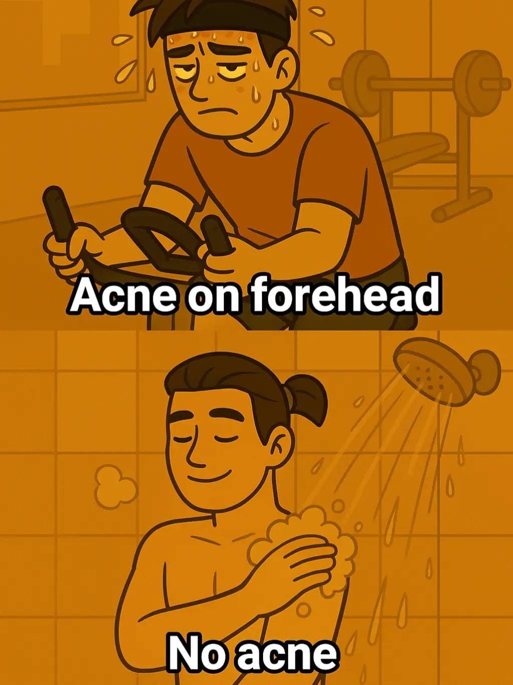 Acne on forehead
No acne