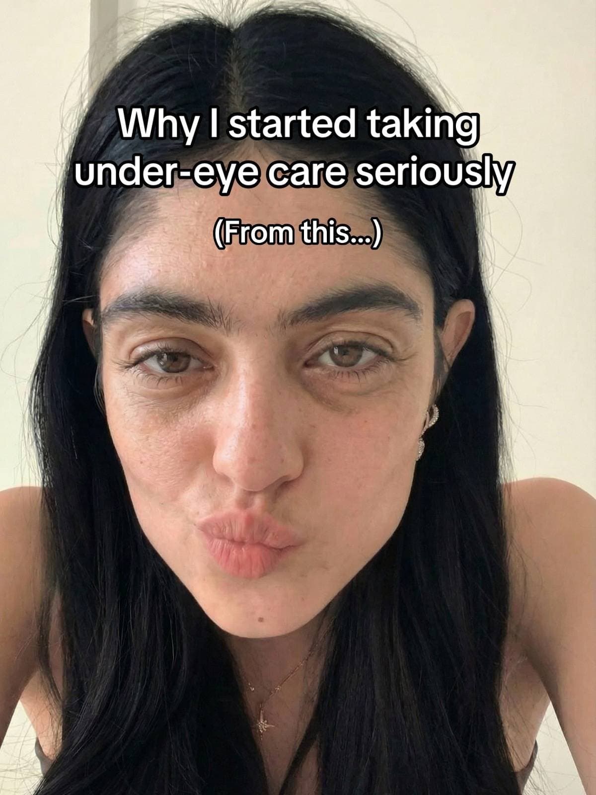 Why I started taking
under-eye care seriously
(From this...)