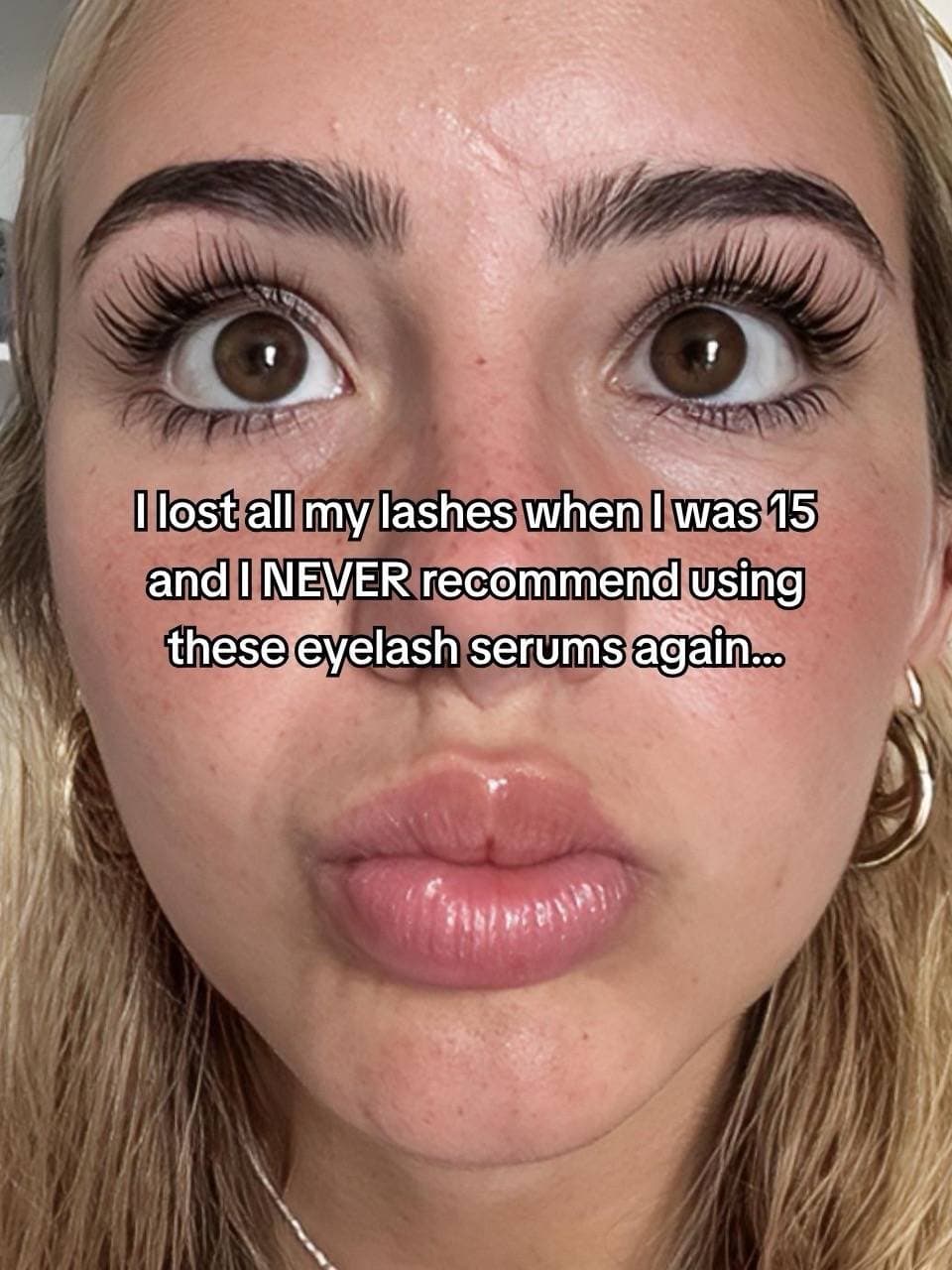 I lost all my lashes when I was 15
and I NEVER recommend using
these eyelash ser…