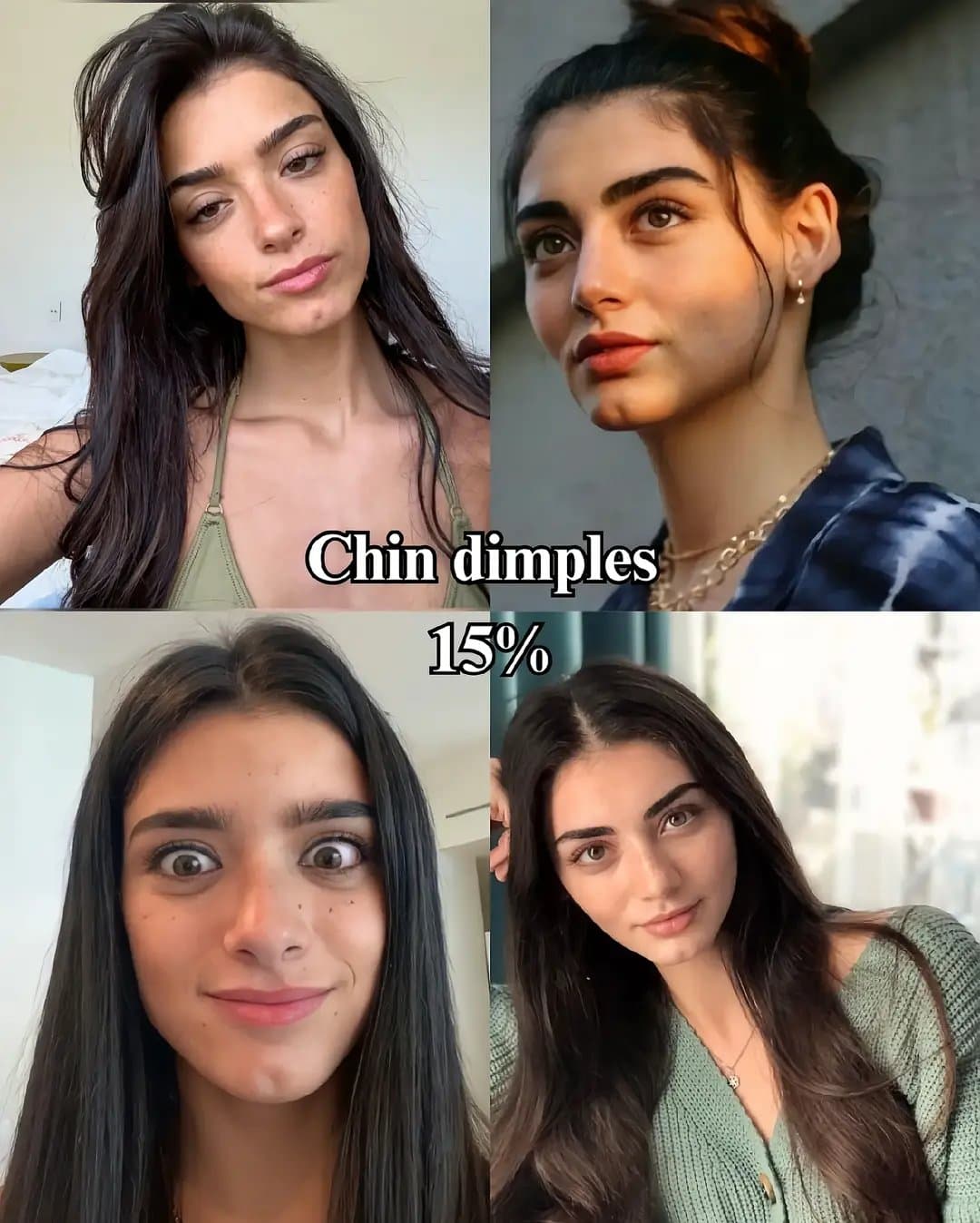 Chin dimples 
15%