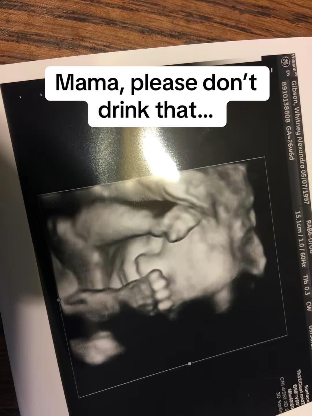 It can hurt my brain

Diet sodas
Energy drinks
Sweetened coffee drinks