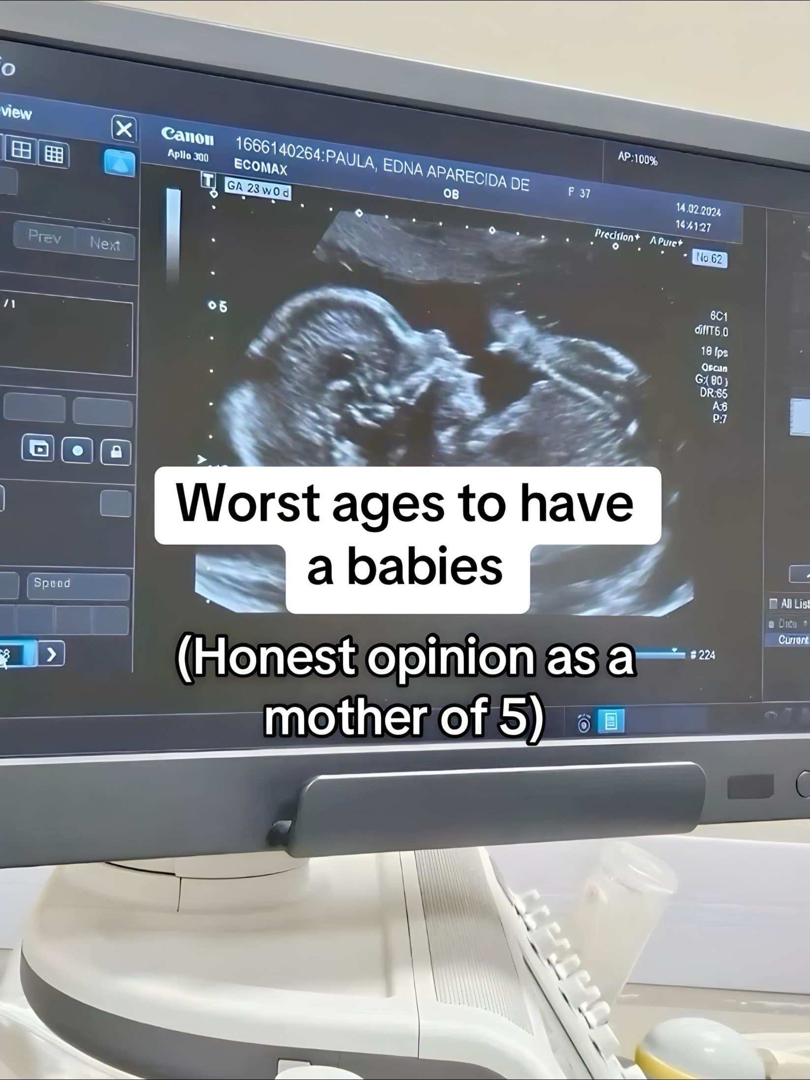 Worst ages to have
a babies

(Honest opinion as a
mother of 5)