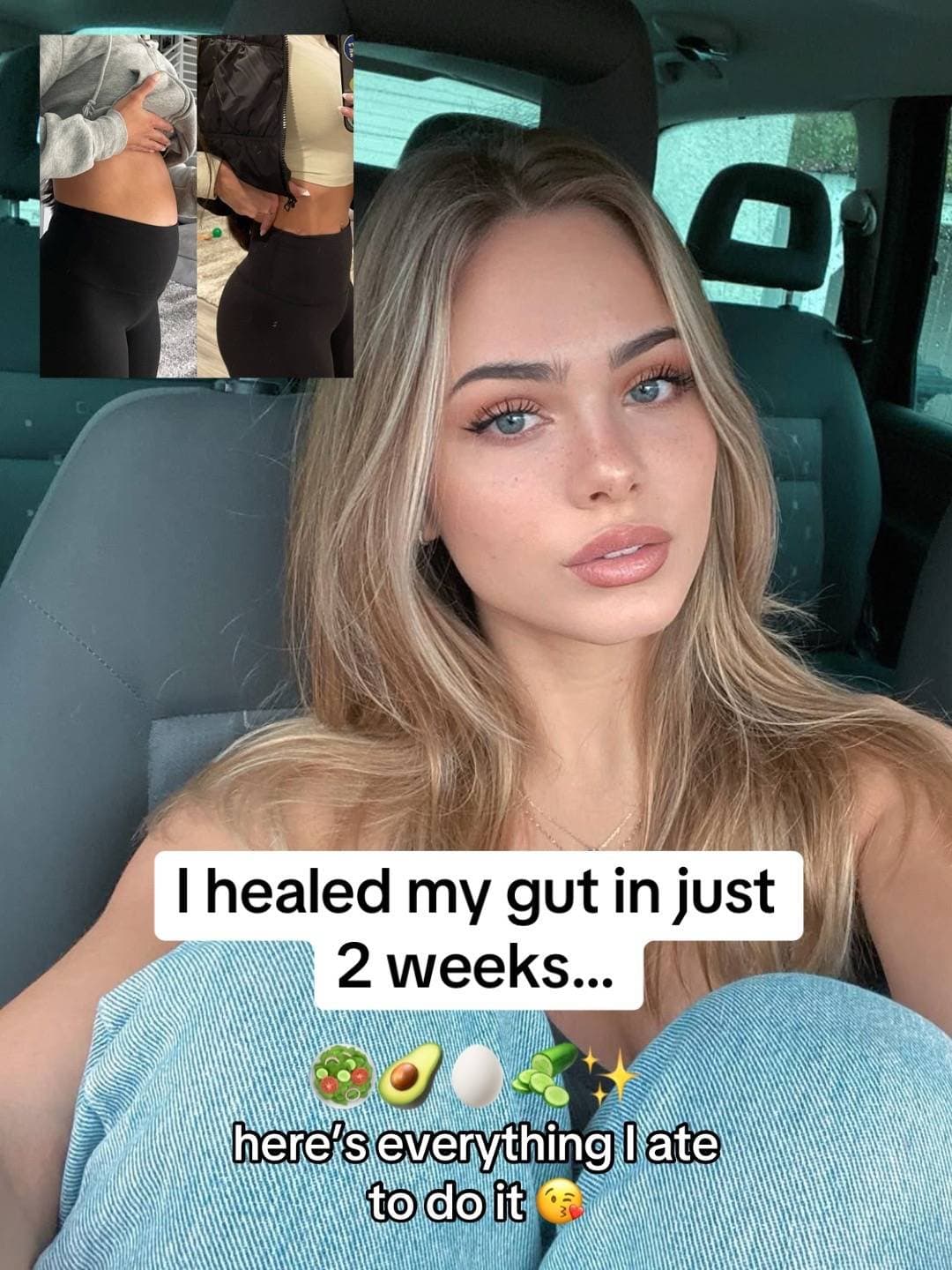 I healed my gut in just
2 weeks...
🥗🥑🥚🥒✨
here's everything I ate
to do it 🥺