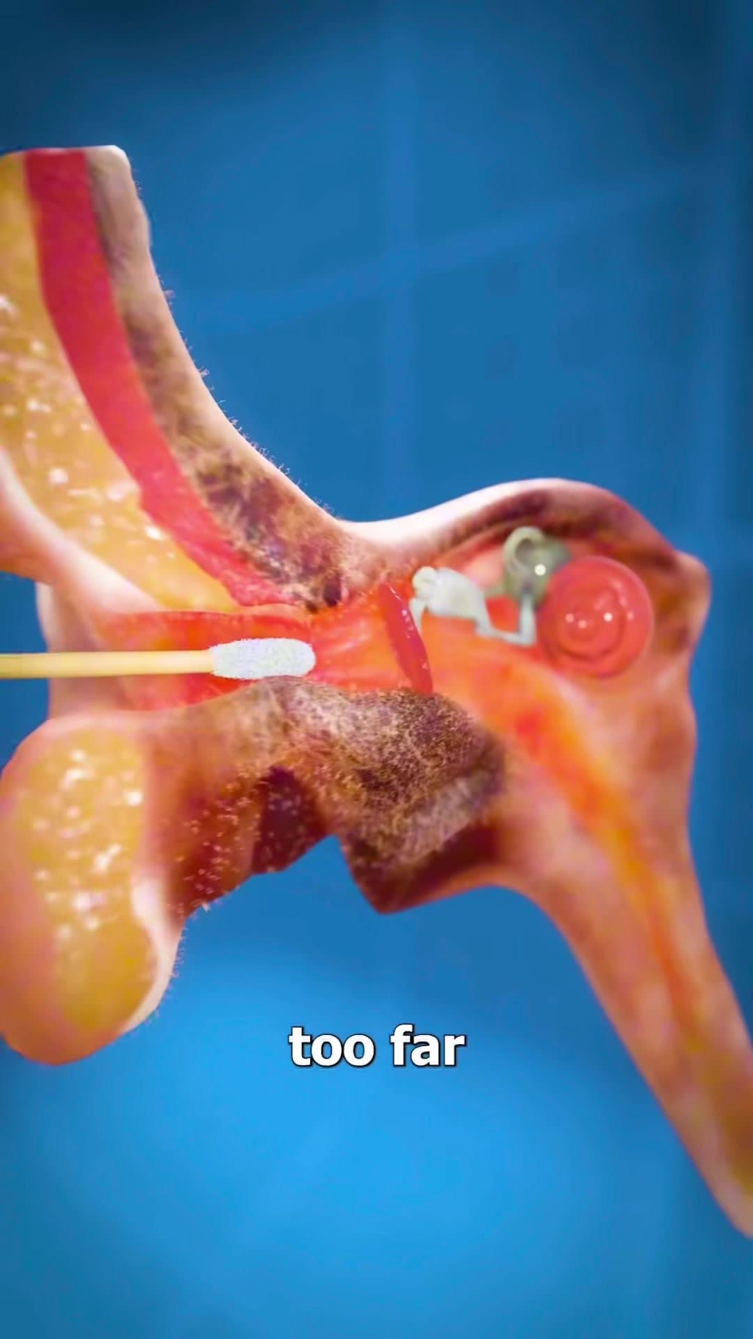 If you stick a Q-tip
too far into your ear
you can actually poke through 

go to…