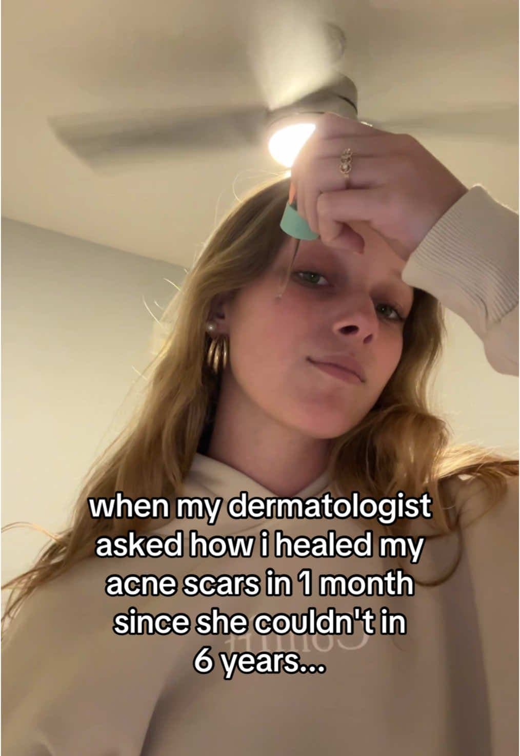 when my dermatologist
asked how i healed my
acne scars in 1 month
since she coul…