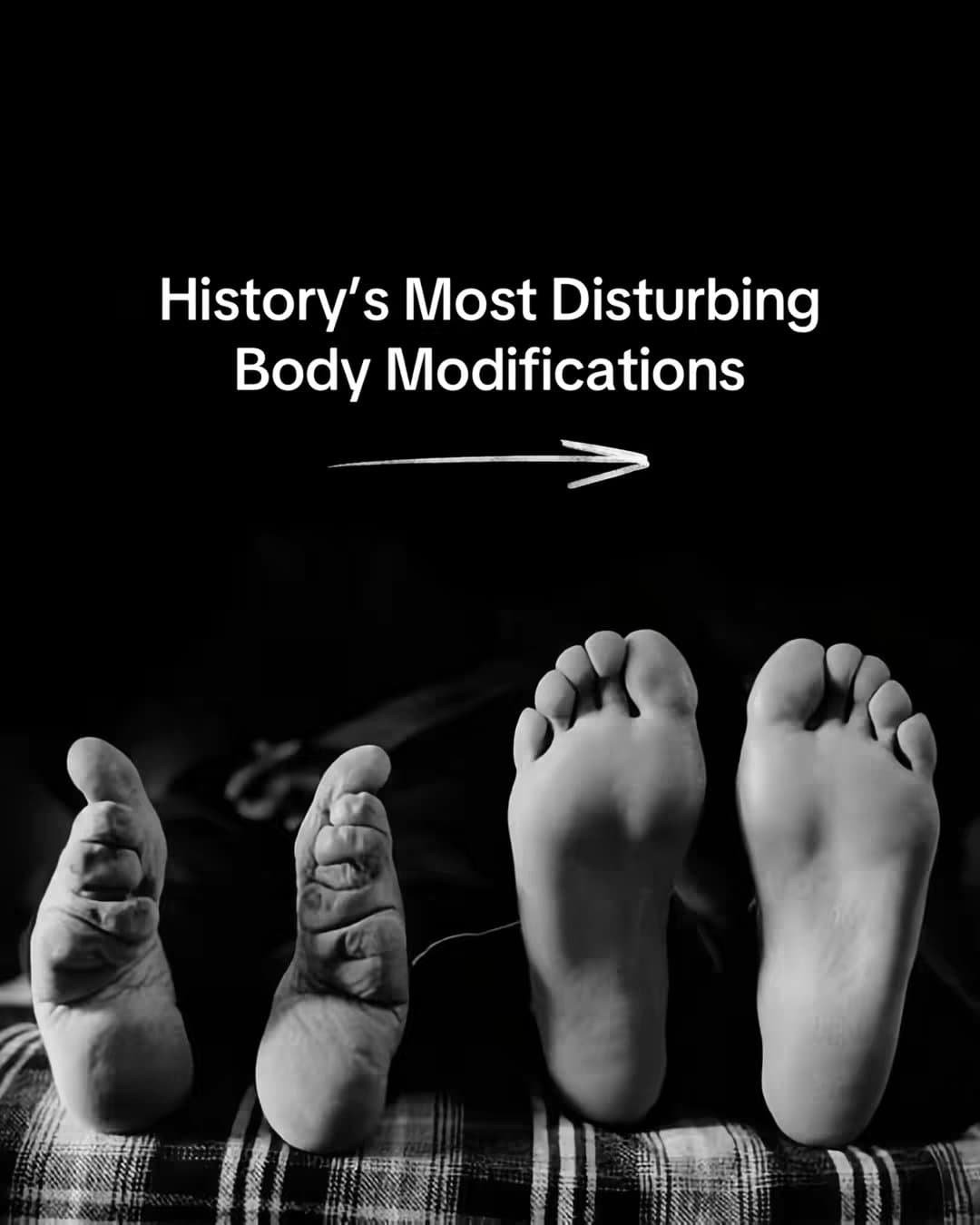 History's Most Disturbing Body Modifications